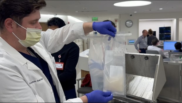 Stanford cell therapy technologist Thomas Orozco thaws the treated immune cells from a patient with advanced melanoma. The cells are collected from the patient's tumor and fortified in a laboratory to better fight the cancer.